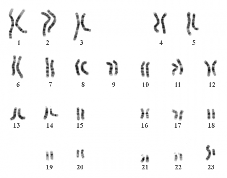 İnsan(Erkek) Kromozom Seti(Diploid) - Karyotip görüntüsü